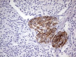 KRT19 Monoclonal Antibody (OTI1F5), TrueMAB , OriGene:Antibodies:Primary