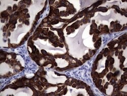 KRT19 Monoclonal Antibody (OTI1E7), TrueMAB , OriGene 100 &mu;L; Unconjugated:Antibodies,