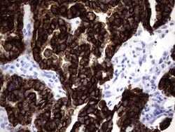 KRT19 Monoclonal Antibody (OTI1E7), TrueMAB , OriGene 100 &mu;L; Unconjugated:Antibodies,