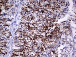 KRT19 Monoclonal Antibody (OTI1E7), TrueMAB , OriGene 100 &mu;L; Unconjugated:Antibodies,