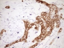 KRT19 Mouse anti-Human, Clone: OTI6A8, lyophilized, TrueMAB 100 &mu;g;