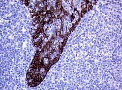 KRT19 Mouse anti-Human, Clone: OTI6A8, lyophilized, TrueMAB 100 &mu;g;