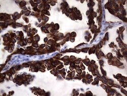 KRT19 Mouse anti-Human, Clone: OTI6E8, lyophilized, TrueMAB 100 &mu;g;