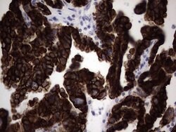 KRT19 Mouse anti-Human, Clone: OTI6E8, lyophilized, TrueMAB 100 &mu;g;