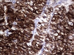 KRT19 Mouse anti-Human, Clone: OTI6E8, lyophilized, TrueMAB 100 &mu;g;