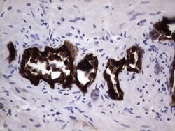 KRT19 Mouse anti-Human, Clone: OTI6E8, lyophilized, TrueMAB 100 &mu;g;