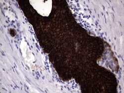 KRT19 Mouse anti-Human, Clone: OTI6E8, lyophilized, TrueMAB 100 &mu;g;