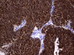 KRT19 Mouse anti-Human, Clone: OTI6E8, lyophilized, TrueMAB 100 &mu;g;