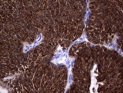 KRT19 Monoclonal Antibody (OTI6E8), TrueMAB , OriGene 100 &mu;L; Unconjugated:Antibodies,