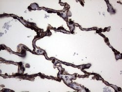 KRT19 Mouse anti-Human, Clone: OTI6E8, lyophilized, TrueMAB 100 &mu;g;