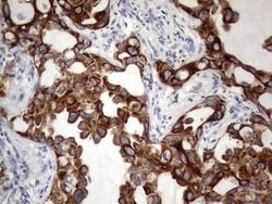 KRT19 Monoclonal Antibody (OTI8H7), TrueMAB , OriGene 100 &mu;L; Unconjugated:Antibodies,