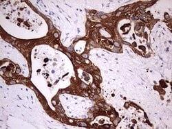 KRT19 Monoclonal Antibody (OTI8H7), TrueMAB , OriGene 100 &mu;L; Unconjugated:Antibodies,