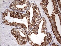 KRT19 Monoclonal Antibody (OTI8H7), TrueMAB , OriGene 100 &mu;L; Unconjugated:Antibodies,