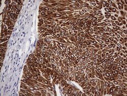 KRT19 Monoclonal Antibody (OTI8H7), TrueMAB , OriGene 100 &mu;L; Unconjugated:Antibodies,