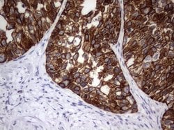 KRT19 Monoclonal Antibody (OTI8H7), TrueMAB , OriGene 100 &mu;L; Unconjugated:Antibodies,