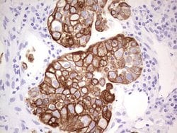 KRT19 Monoclonal Antibody (OTI7H1), TrueMAB , OriGene 100 &mu;L; Unconjugated:Antibodies,
