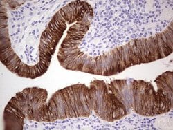 KRT19 Monoclonal Antibody (OTI7H1), TrueMAB , OriGene 100 &mu;L; Unconjugated:Antibodies,