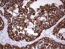 KRT19 Monoclonal Antibody (OTI7H1), TrueMAB , OriGene 100 &mu;L; Unconjugated:Antibodies,