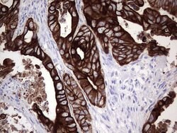 KRT19 Monoclonal Antibody (OTI5H6), TrueMAB , OriGene 100 &mu;L; Unconjugated:Antibodies,