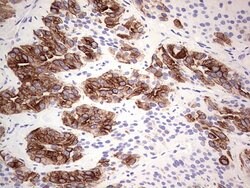 KRT19 Monoclonal Antibody (OTI5F4), TrueMAB , OriGene 100 &mu;L; Unconjugated:Antibodies,