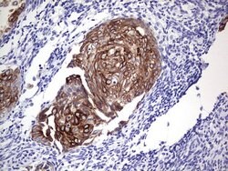 KRT19 Monoclonal Antibody (OTI5F4), TrueMAB , OriGene 100 &mu;L; Unconjugated:Antibodies,