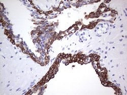 KRT19 Monoclonal Antibody (OTI5F4), TrueMAB , OriGene 100 &mu;L; Unconjugated:Antibodies,