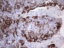 KRT19 Monoclonal Antibody (OTI5F4), TrueMAB , OriGene 100 &mu;L; Unconjugated:Antibodies,