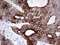 KRT19 Monoclonal Antibody (OTI5F4), TrueMAB , OriGene 100 &mu;L; Unconjugated:Antibodies,