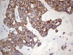 KRT19 Monoclonal Antibody (OTI5F4), TrueMAB , OriGene 100 &mu;L; Unconjugated:Antibodies,