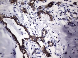 KRT19 Mouse anti-Human, Clone: OTI8D1, lyophilized, TrueMAB 100 &mu;g;
