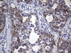 KRT19 Mouse anti-Human, Clone: OTI8D1, lyophilized, TrueMAB 100 &mu;g;