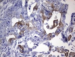 KRT19 Mouse anti-Human, Clone: OTI8D1, lyophilized, TrueMAB 100 &mu;g;