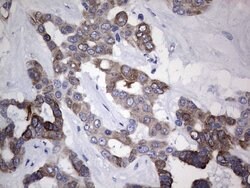 KRT19 Mouse anti-Human, Clone: OTI8D1, lyophilized, TrueMAB 100 &mu;g;