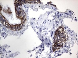 KRT19 Mouse anti-Human, Clone: OTI8D1, lyophilized, TrueMAB 100 &mu;g;