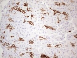 KRT19 Mouse anti-Human, Clone: UMAB187, lyophilized, UltraMAB 100 &mu;g | Buy Online | OriGene | Fisher Scientific