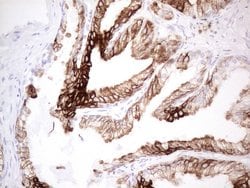 KRT19 Mouse anti-Human, Clone: UMAB187, lyophilized, UltraMAB 100 &mu;g | Buy Online | OriGene | Fisher Scientific