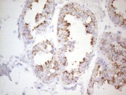 KRT19 Mouse anti-Human, Clone: UMAB187, lyophilized, UltraMAB 100 &mu;g | Buy Online | OriGene | Fisher Scientific