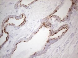 KRT19 Mouse anti-Human, Clone: UMAB187, lyophilized, UltraMAB 100 &mu;g | Buy Online | OriGene | Fisher Scientific