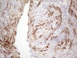 KRT19 Mouse anti-Human, Clone: UMAB187, lyophilized, UltraMAB 100 &mu;g | Buy Online | OriGene | Fisher Scientific