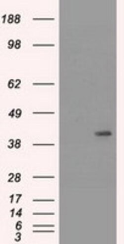 KRT19 Mouse anti-Canine, Human, Rat, Clone: OTI3F8, lyophilized, TrueMAB