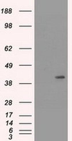 KRT19 Mouse anti-Canine, Human, Rat, Clone: OTI3F8, liquid, TrueMAB 100