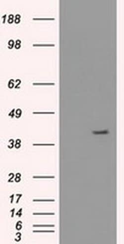 KRT19 Mouse anti-Human, Clone: OTI4E12, liquid, TrueMAB 100 &mu;L | Buy Online | Origene Technologies | Fisher Scientific