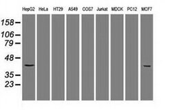 KRT19 Mouse anti-Human, Clone: OTI4E12, liquid, TrueMAB 100 &mu;L | Buy Online | Origene Technologies | Fisher Scientific