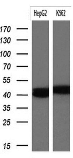 KRT19 Monoclonal Antibody (OTI1F5), TrueMAB , OriGene 100 &mu;L; Unconjugated:Antibodies,