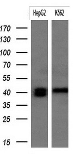 KRT19 Monoclonal Antibody (OTI1E7), TrueMAB , OriGene 100 &mu;L; Unconjugated:Antibodies,