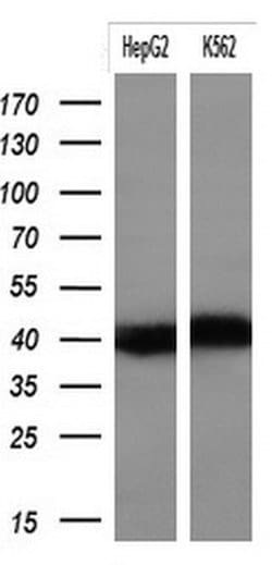 KRT19 Mouse anti-Human, Clone: OTI6A8, lyophilized, TrueMAB 100 &mu;g;