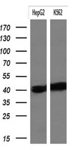 KRT19 Monoclonal Antibody (OTI7H7), TrueMAB , OriGene:Antibodies:Primary