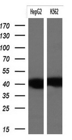 KRT19 Mouse anti-Human, Clone: OTI6E8, lyophilized, TrueMAB 100 &mu;g;