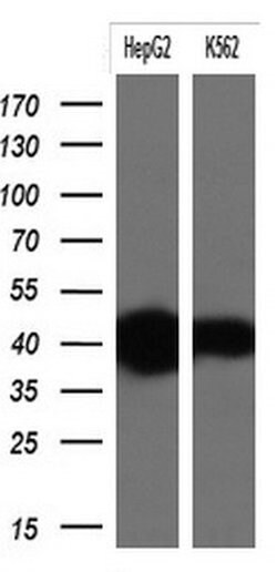 KRT19 Monoclonal Antibody (OTI5G7), TrueMAB , OriGene 100 &mu;L; Unconjugated:Antibodies,