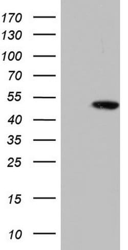 KRT19 Monoclonal Antibody (OTI8H7), TrueMAB , OriGene 100 &mu;L; Unconjugated:Antibodies,
